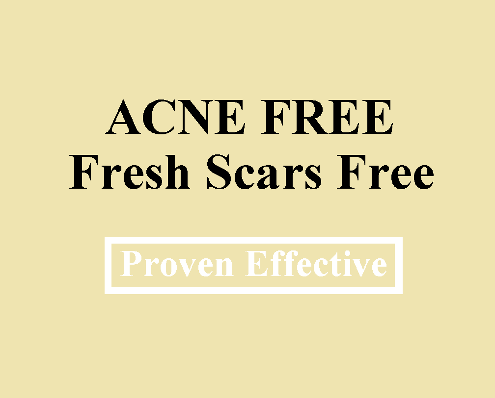treat acne naturally